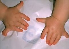 100.000 euro schadevergoeding voor ouders van een gehandicapt kind