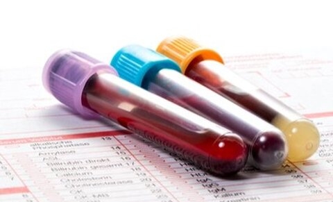 Usage autologue du sang de cordon : aspects cliniques et scientifiques