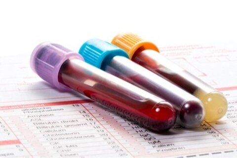 Usage autologue du sang de cordon : aspects cliniques et scientifiques