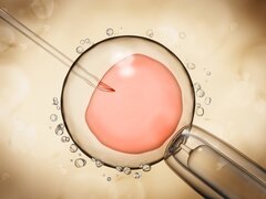 Oproep KU Leuven om spermadonor te worden