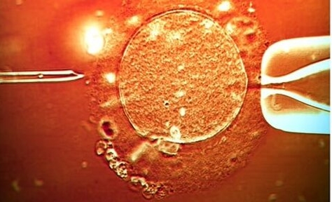 Cardio 3 : des cellules souches adultes pour régénérer le coeur fragilisé