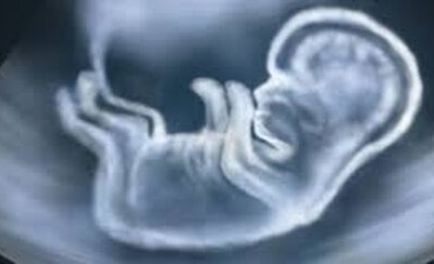 Niet invasieve test genetische screening Trisomie 21
