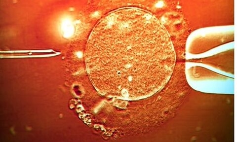Union européenne : autorisation d’un médicament à base de cellules souches humaines