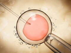 Pays-Bas : des 100.000 embryons humains conçus in vitro par an, que reste-t-il ?