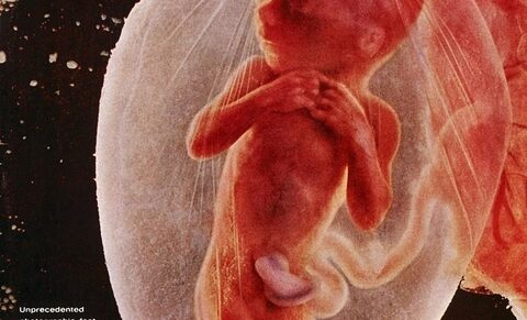 Foetus de 4 mois (photo) : une majorité politique s'apprête à en autoriser l'avortement