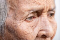 Vers l’euthanasie des personnes démentes sans leur consentement verbal ?