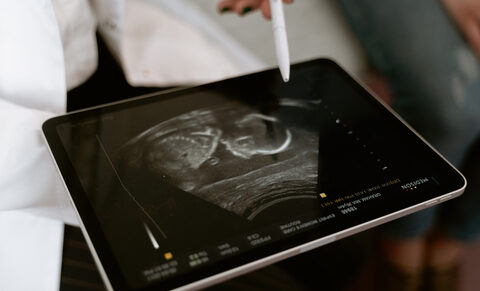 Délai d’avortement de 12 à 14 semaines en France : des conséquences néfastes pour les femmes et les médecins