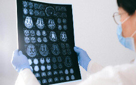 Alzheimer : prédire l’apparition de la maladie pour mieux la traiter