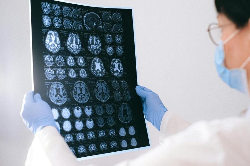 Een betere voorspelling van Alzheimer geeft zicht op een betere behandeling