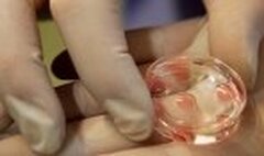 La fécondation in vitro est–elle incontestable ?