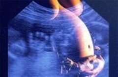 Avis n°53 : Comité Consultatif de Bioéthique Effet sur foetus