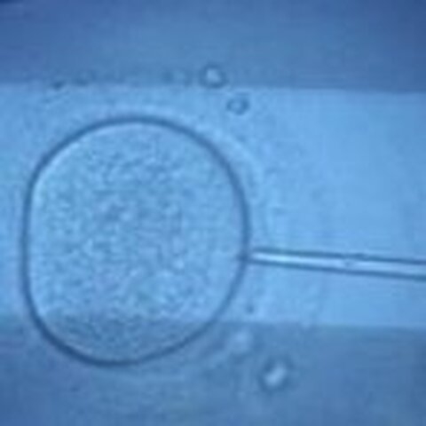 Fiche didactique - Diagnostic préimplantatoire